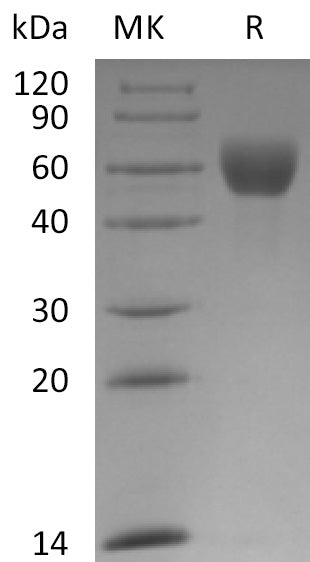 BL-1941NP: Greater than 95% as determined by reducing SDS-PAGE. (QC verified)Recombinant Mouse Fetuin A Protein (C-10His)