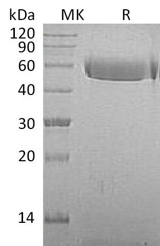 BL-1942NP: Greater than 95% as determined by reducing SDS-PAGE. (QC verified)Recombinant Macaca mulatta Fetuin A Protein (C-10His)