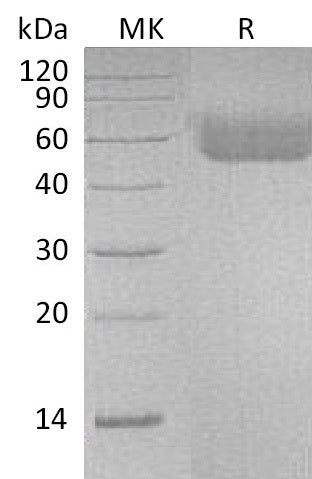 BL-1064NP: Greater than 95% as determined by reducing SDS-PAGE. (QC verified)Recombinant Human IL-1R1 Protein (C-6His)