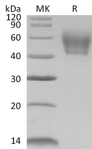 BL-1066NP: Greater than 95% as determined by reducing SDS-PAGE. (QC verified)Recombinant Mouse IL-1R2 Protein (C-6His)