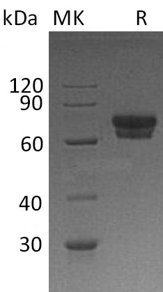 BL-0100NP: Greater than 95% as determined by reducing SDS-PAGE. (QC verified)Recombinant Human IL-2RA Protein (C-Fc)