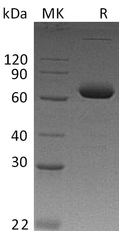 BL-0102NP: Greater than 95% as determined by reducing SDS-PAGE. (QC verified)Recombinant Human IL-2RB Protein (C-Fc)