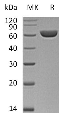 BL-0990NP: Greater than 95% as determined by reducing SDS-PAGE. (QC verified)Recombinant Mouse CES3 Protein (C-6His)