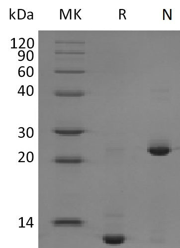 BL-1912NP: Greater than 95% as determined by reducing SDS-PAGE. (QC verified)Recombinant Mouse/Rat TGF-beta 2 Protein