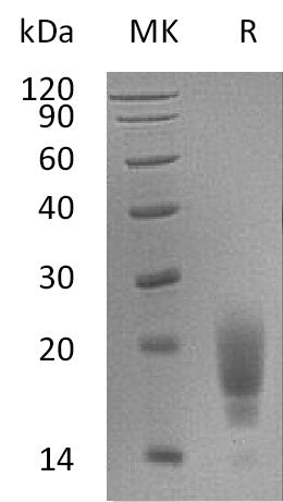 BL-0996NP: Greater than 95% as determined by reducing SDS-PAGE. (QC verified)Recombinant Mouse TIGIT Protein (C-6His)