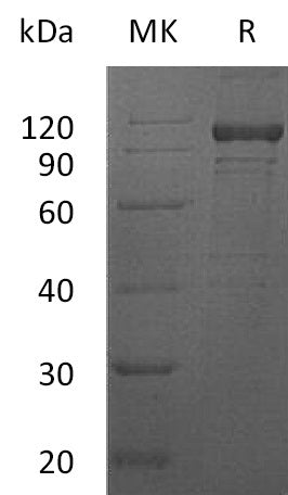 BL-0113NP: Greater than 90% as determined by reducing SDS-PAGE. (QC verified)Recombinant Human IL-12RB1 Protein (C-Fc)