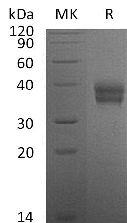 BL-1007NP: Greater than 95% as determined by reducing SDS-PAGE. (QC verified)Recombinant Mouse Carbonic Anhydrase 12 Protein (C-6His)
