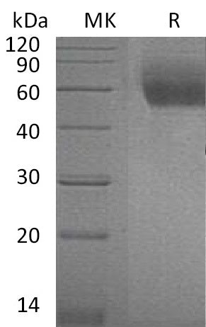 BL-1016NP: Greater than 95% as determined by reducing SDS-PAGE. (QC verified)Recombinant Mouse ST2 Protein (C-6His)