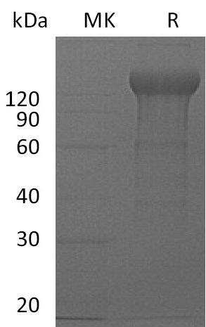 BL-0124NP: Greater than 95% as determined by reducing SDS-PAGE. (QC verified)Recombinant Mouse IL-12RB2 Protein (C-Fc)