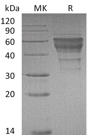 BL-0130NP: Greater than 95% as determined by reducing SDS-PAGE. (QC verified)Recombinant Mouse TIM-3 Protein (C-Fc)