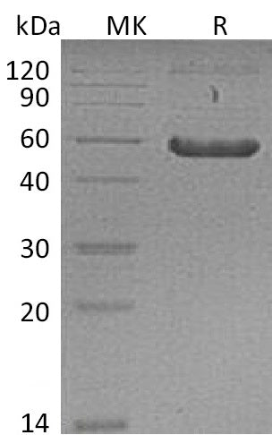 BL-0133NP: Greater than 95% as determined by reducing SDS-PAGE. (QC verified)Recombinant Mouse FZD2 Protein (C-Fc)