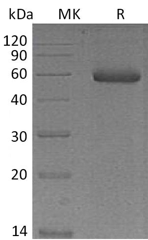 BL-0243NP: Greater than 95% as determined by reducing SDS-PAGE. (QC verified)Recombinant Mouse NGAL Protein (C-Fc)