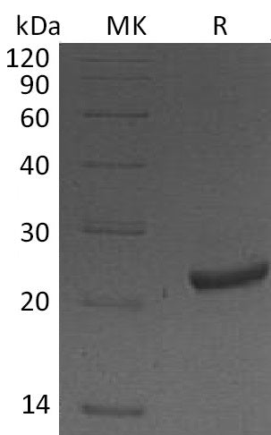 BL-1628NP: Greater than 95% as determined by reducing SDS-PAGE. (QC verified)Recombinant Mouse NGAL Protein (C-6His)