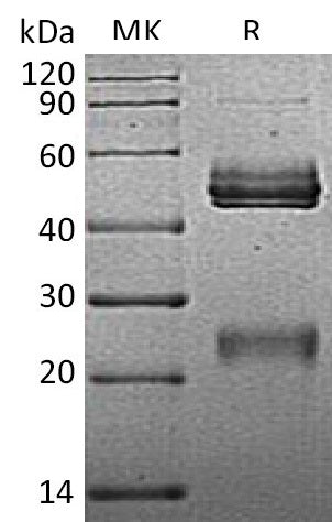 BL-1925NP: Greater than 90% as determined by reducing SDS-PAGE. (QC verified)Recombinant Mouse IL-12 Protein