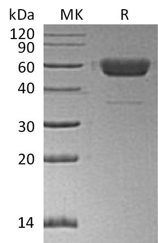 BL-0136NP: Greater than 95% as determined by reducing SDS-PAGE. (QC verified)Recombinant Human/Mouse/Rat Irisin Protein (C-Fc)