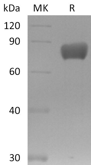 BL-0141NP: Greater than 95% as determined by reducing SDS-PAGE. (QC verified)Recombinant Mouse FSTL1 Protein (C-Fc)