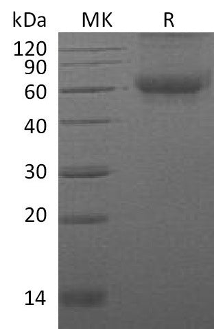 BL-1035NP: Greater than 95% as determined by reducing SDS-PAGE. (QC verified)Recombinant Mouse DDR2 Protein (C-6His)