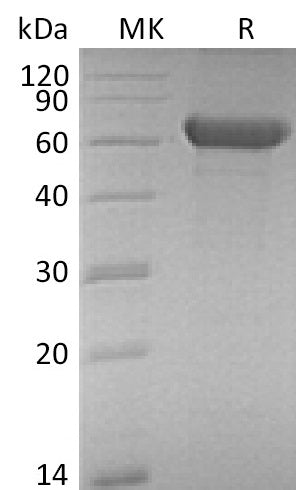 BL-0143NP: Greater than 95% as determined by reducing SDS-PAGE. (QC verified)Recombinant Mouse FZD1 Protein (C-Fc)