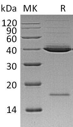 BL-1043NP: Greater than 95% as determined by reducing SDS-PAGE. (QC verified)Recombinant Human Mindin Protein (C-6His)