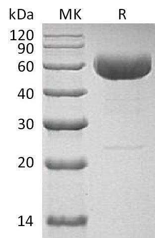BL-1929NP: Greater than 95% as determined by reducing SDS-PAGE. (QC verified)Recombinant Human IL-22 Protein (C-hIgG4 Fc)
