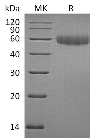BL-1045NP: Greater than 95% as determined by reducing SDS-PAGE. (QC verified)Recombinant Mouse TREML2 Protein (C-6His)
