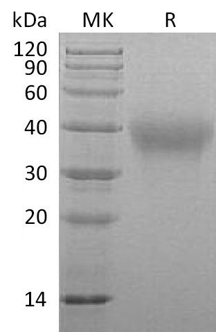 BL-1044NP: Greater than 95% as determined by reducing SDS-PAGE. (QC verified)Recombinant Marmoset TIM-3 Protein (C-6His)