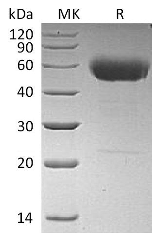BL-1928NP: Greater than 95% as determined by reducing SDS-PAGE. (QC verified)Recombinant Human IL-22 Protein (C-hIgG2 Fc)