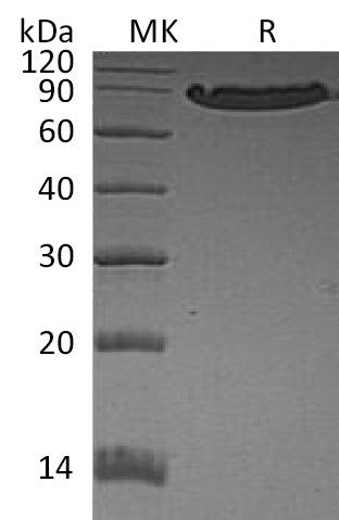 BL-0963NP: Greater than 95% as determined by reducing SDS-PAGE. (QC verified)Recombinant Human CDH1 Protein (C-6His)
