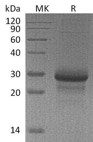 BL-1934NP: Greater than 90% as determined by reducing SDS-PAGE. (QC verified)Recombinant Mouse MBL-2 Protein