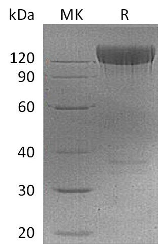 BL-0149NP: Greater than 95% as determined by reducing SDS-PAGE. (QC verified)Recombinant Mouse PDGFRA Protein (C-Fc)
