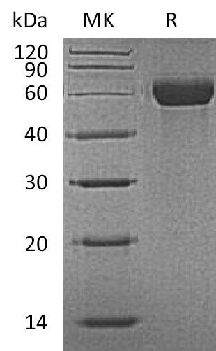 BL-2003NP: Greater than 90% as determined by reducing SDS-PAGE. (QC verified)Recombinant Mouse MARCO Protein (N-8His)