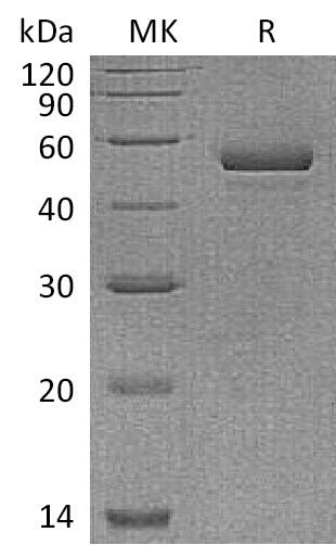 BL-1177NP: Greater than 95% as determined by reducing SDS-PAGE. (QC verified)Recombinant Human NPTX1 Protein (C-6His)