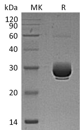 BL-1181NP: Greater than 95% as determined by reducing SDS-PAGE. (QC verified)Recombinant Mouse ANGPTL3 Protein (C-6His)
