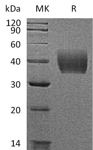 BL-1185NP: Greater than 95% as determined by reducing SDS-PAGE. (QC verified)Recombinant Mouse TF Protein (C-6His)