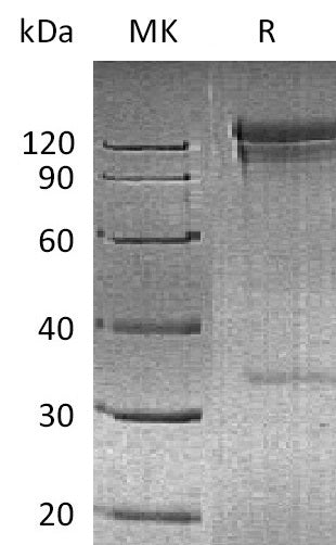 BL-2090NP: Greater than 95% as determined by reducing SDS-PAGE. (QC verified)Recombinant Human CD26 Protein (N-Fc)