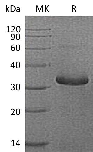 BL-1184NP: Greater than 95% as determined by reducing SDS-PAGE. (QC verified)Recombinant Human IGFBP-1 Protein (C-6His)