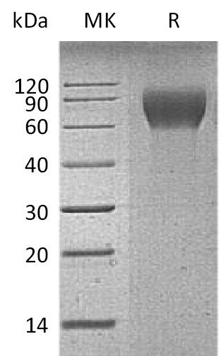 BL-1182NP: Greater than 90% as determined by reducing SDS-PAGE. (QC verified)Recombinant Mouse CD6 Protein (C-6His)
