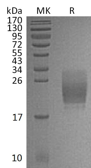 BL-1162NP: Greater than 95% as determined by reducing SDS-PAGE. (QC verified)Recombinant Mouse CD160 Protein (C-6His)