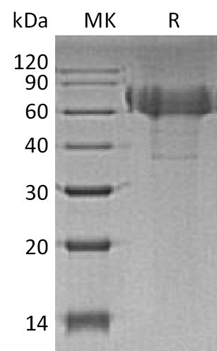 BL-1164NP: Greater than 95% as determined by reducing SDS-PAGE. (QC verified)Recombinant Human TIM-4 Protein (C-6His)