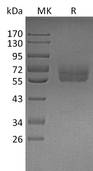 BL-1163NP: Greater than 90% as determined by reducing SDS-PAGE. (QC verified)Recombinant Human Dtk Protein (C-6His)