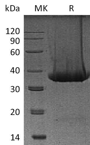 BL-1169NP: Greater than 95% as determined by reducing SDS-PAGE. (QC verified)Recombinant Mouse Kallikrein 1 Protein (C-6His)