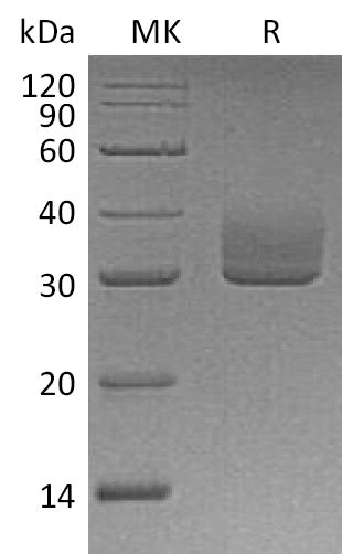BL-1173NP: Greater than 95% as determined by reducing SDS-PAGE. (QC verified)Recombinant Human ANGPTL3 Protein (C-6His)