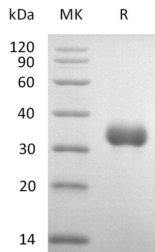 BL-1174NP: Greater than 95% as determined by reducing SDS-PAGE. (QC verified)Recombinant Human IGFBP-7 Protein (C-6His)