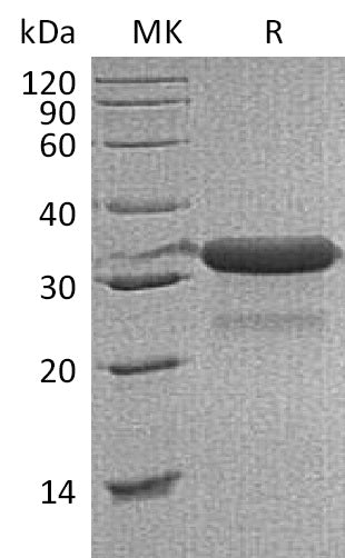 BL-1175NP: Greater than 95% as determined by reducing SDS-PAGE. (QC verified)Recombinant Mouse IGFBP-7 Protein (C-6His)