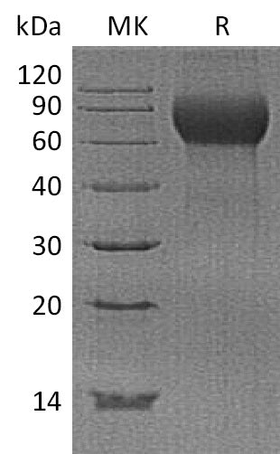 BL-1653NP: Greater than 95% as determined by reducing SDS-PAGE. (QC verified)Recombinant Human Hemopexin Protein (C-6His)