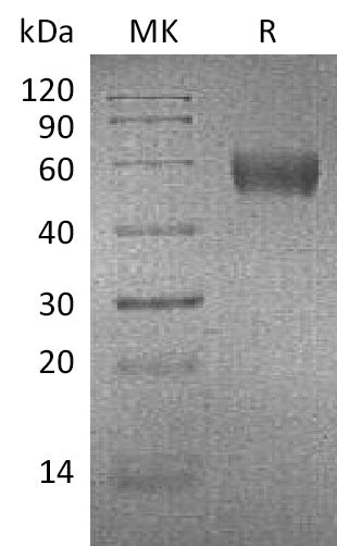 BL-1170NP: Greater than 95% as determined by reducing SDS-PAGE. (QC verified)Recombinant Mouse ApoH Protein (C-6His)