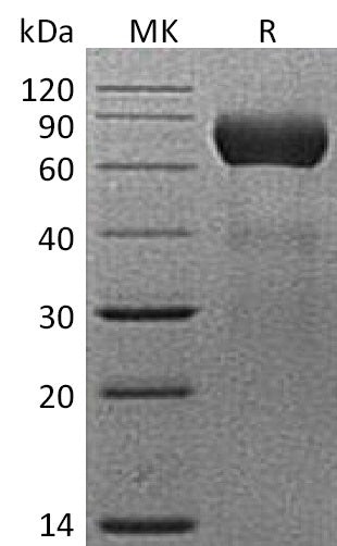 BL-1650NP: Greater than 95% as determined by reducing SDS-PAGE. (QC verified)Recombinant Mouse CD39L1 Protein (C-6His)