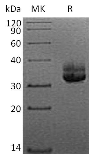 BL-2175NP: Greater than 95% as determined by reducing SDS-PAGE. (QC verified)Recombinant Human CD207 Protein (N-6His)