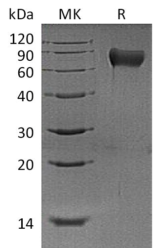 BL-1652NP: Greater than 95% as determined by reducing SDS-PAGE. (QC verified)Recombinant Mouse Hemopexin Protein (C-6His)