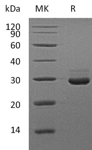 BL-1636NP: Greater than 95% as determined by reducing SDS-PAGE. (QC verified)Recombinant Mouse VSIG8 Protein (C-6His)